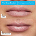 Huulte kaitse DR.JART+ VITAL HYDRA SOLUTION