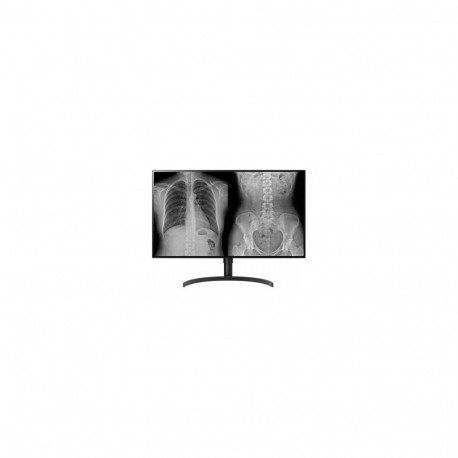 LG DIAGNOSTIC MONITOR, 31.5", 8MP, 450CD/M2, DCI-P3 98%, HAS/PIVOT.