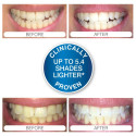 Rio USB Teeth Whitening